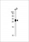 HLA-DRB4 Antibody (N-term)